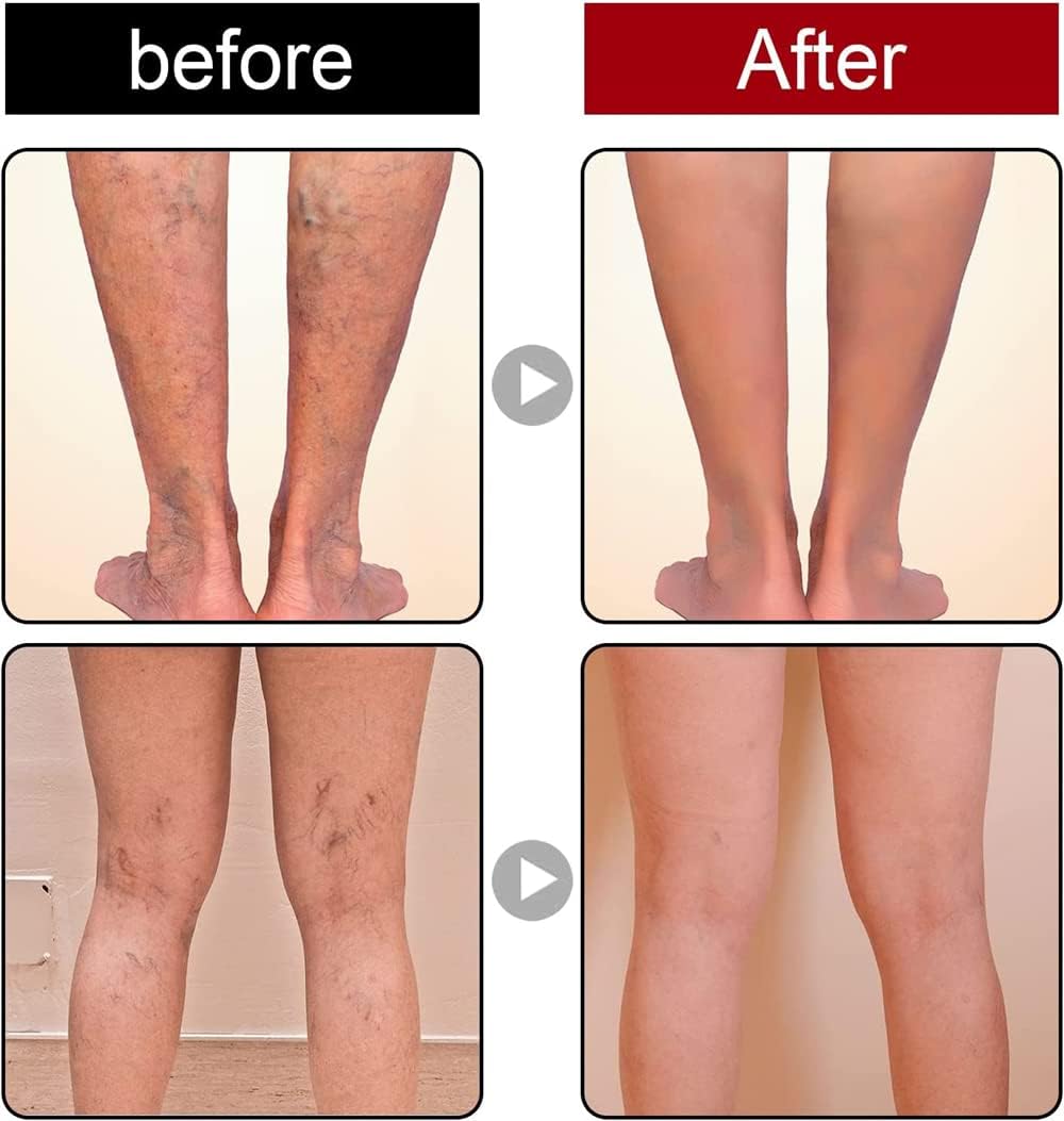 Gel Rinfrescante per VenaTM