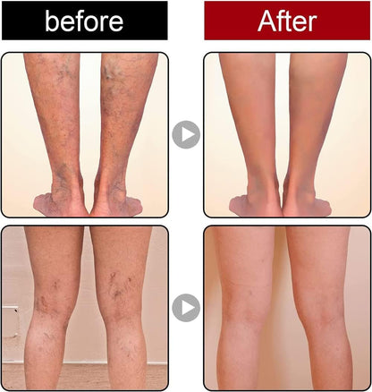 Gel Rinfrescante per VenaTM