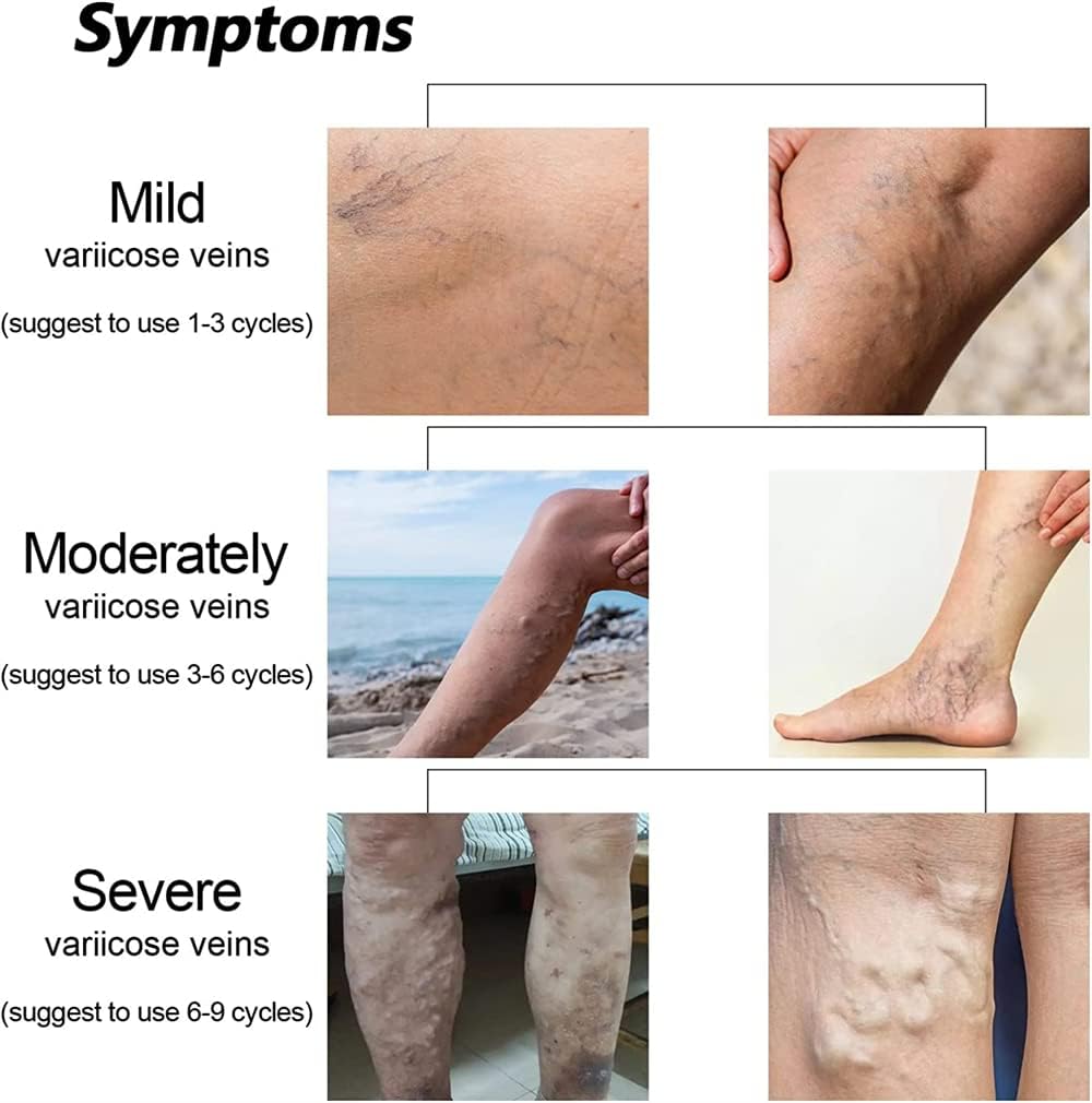 Gel Rinfrescante per VenaTM